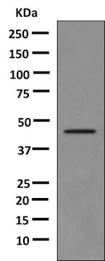 Anti-Growth Hormone antibody [EPR9524-21] (ab155975) at 1/1000 dilution + Proprietary tagged Human Growth Hormone recombinant protein at 10 µgSecondaryHRP labeled goat anti-rabbit IgG at 1/2000 dilution