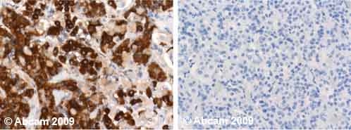 Human normal brain (pituitary gland). Staining is observed in the cytoplasm and in the extracellulat space. Left panel: with primary antibody at 1 ug/ml. Right panel: isotype control. Sections were stained using an automated system DAKO Autostainer Plus , at room temperature: sections were rehydrated and antigen retrieved with the Dako 3 in 1 AR buffers citrate pH6.1 in a DAKO PT Link. Slides were peroxidase blocked in 3% H2O2 in methanol for 10 mins. They were then blocked with Dako Protein block for 10 minutes (containing casein 0.25% in PBS) then incubated with primary antibody for 20 min and detected with Dako envision flex amplification kit for mouse for 30 minutes. Colorimetric detection was completed with Diaminobenzidine for 5 minutes. Slides were counterstained with Haematoxylin and coverslipped under DePeX. Please note that for manual staining we recommend to optimize the primary antibody concentration and incubation time (overnight incubation), and amplification may be requi