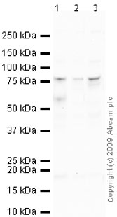 All lanes : Anti-Growth hormone receptor antibody (ab65304) at 1 µg/mlLane 1 : A549 (Human lung adenocarcinoma epithelial cell line) Whole Cell Lysate Lane 2 : HeLa (Human epithelial carcinoma cell line) Whole Cell Lysate Lane 3 : DU 145 (Human prostate carcinoma cell line) Whole Cell Lysate Lysates/proteins at 10 µg per lane.SecondaryGoat polyclonal to Rabbit IgG - H&L - Pre-Adsorbed (HRP) at 1/3000 dilutiondeveloped using the ECL techniquePerformed under reducing conditions.