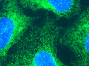 Methanol-fixed HEK293 cells stained at 1/200 with ab18055 followed by FITC conjugated secondary.
