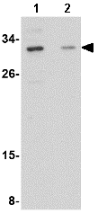 All lanes : Anti-GRTP1 antibody (ab73284)Lane 1 : SK-N-SH cell lysate Lane 2 : SK-N-SH cell lysate with blocking peptideLysates/proteins at 15 µg per lane.