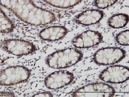 GSC antibody (ab58352) used in immunohistochemistry at 3ug/ml on formalin fixed and paraffin embedded human colon.