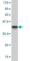 Western blot against tagged recombinant protein immunogen using ab58352 GSC antibody at 1ug/ml.