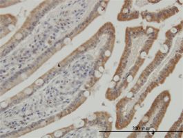 CSNK1G1 antibody (ab57244) used in immunohistochemistry at 3ug/ml on formalin fixed and paraffin embedded human small Intestine.