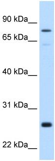 Anti-GSTM2 antibody (ab62550) at 0.25 µg/ml + Fetal liver cell lysate at 10 µgSecondaryHRP conjugated anti-Rabbit IgG (1/50,000 - 1/100,000)