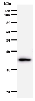 Anti-GTF2A1 antibody [708C4a] (ab50821)