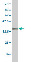 Western blot against tagged recombinant protein immunogen using ab55206 GTF3A antibody at 1ug/ml.