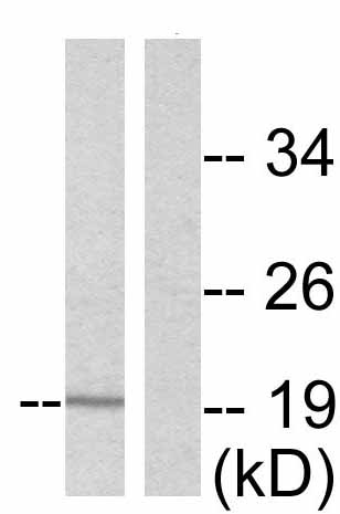 All lanes : Anti-Cofilin (phospho S3) antibody (ab47281) at 1/500 dilutionLane 1 : Extracts from COLO205 cells serum starvedLane 2 : Extracts from COLO205 cells Lysates/proteins at 30 µg per lane.