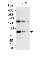 All lanes : Anti-GTF3C4 antibody (ab74229) at 0.04 µg/mlLane 1 : HeLa whole cell lysate at 50 µgLane 2 : HeLa whole cell lysate at 15 µgLane 3 : HeLa whole cell lysate at 5 µgdeveloped using the ECL technique