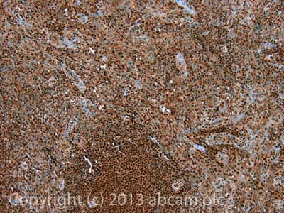 IHC image of GTP cyclohydrolase 1 staining in Human spleen formalin fixed paraffin embedded tissue section, performed on a Leica BondTM system using the standard protocol F. The section was pre-treated using heat mediated antigen retrieval with sodium citrate buffer (pH6, epitope retrieval solution 1) for 20 mins. The section was then incubated with ab61858, 5µg/ml, for 15 mins at room temperature and detected using an HRP conjugated compact polymer system. DAB was used as the chromogen. The section was then counterstained with haematoxylin and mounted with DPX. For other IHC staining systems (automated and non-automated) customers should optimize variable parameters such as antigen retrieval conditions, primary antibody concentration and antibody incubation times.
