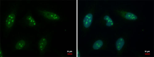 Immunocytochemical analysis of Hela cells fixed in 4% paraformaldehyde at room temperature for 15 mins labeling GTPBP4 with ab184124 at 1/500 dilution (green) and counterstained with Hoechst 33342 (blue)