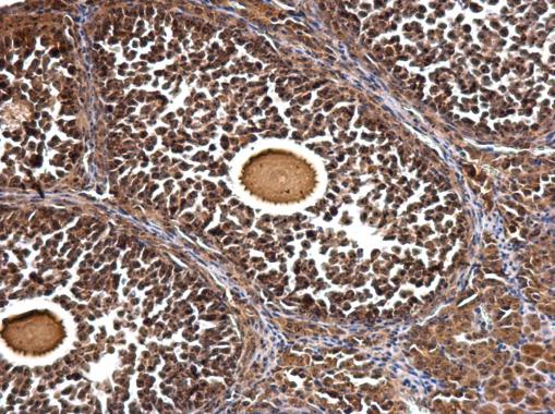 Immunohistochemical staining of paraffin-embedded mouse ovary tissue showing nuclear staining labeling GTPBP4 with ab184124 at 1/500 dilution