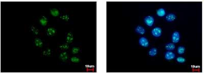 Immunofluorescent analysis of A431 cells (fixed in iced-cold MeOH for 5 min) labeling GTPBP4 with ab153977 at 1/500 dilution (green). Right image shows cells co-stained with Hoechst 33342 (blue).