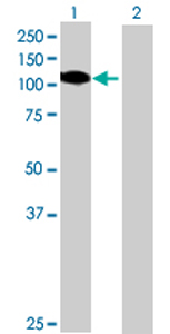 All lanes : Anti-GTSE1 antibody (ab69342) at 1/500 dilutionLane 1 : GTSE1 transfected 293T cell lysateLane 2 : Non-transfected 293T cell lysateLysates/proteins at 25 µg per lane.SecondaryGoat Anti-Mouse IgG (H&L)-HRP Conjugate at 1/2500 dilution