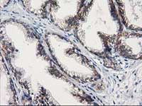 ab119063, at 1/150 dilution, staining Guanylate kinase in paraffin-embedded Human prostate tissue by Immunohistochemistry.