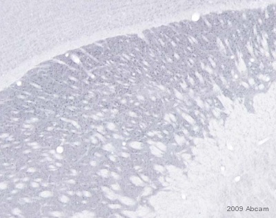 Immunodetection of guanylyl cyclase alpha 2 in mouse brain tissue section using ab42108 (1/100). Please refer to abreview for further experimental details.See Abreview