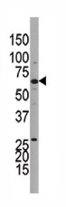 Anti-Guanylyl Cyclase beta 1 antibody - Carboxyterminal end (ab71274) at 1/100 dilution + Y79 cell line lysate at 12.5 µg