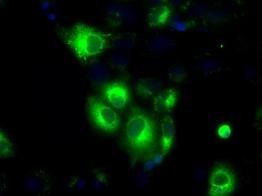 ab119046 at 1/100 dilution staining H6PD in COS7 cells transiently transfected with pCMV6-ENTRY H6PD by Immunofluorescence.