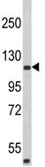 Anti-HA1 antibody (ab175880) at 1/1000 dilution + A2058 cell lysate at 35 µg