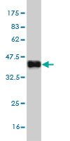 Western blot against tagged recombinant protein immunogen using ab54572 CST6 antibody at 1ug/ml. 