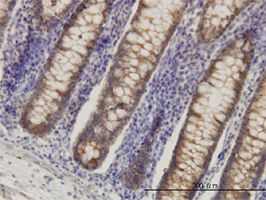 HADHSC antibody (ab55231) used in immunohistochemistry at 3ug/ml on formalin fixed and paraffin embedded human colon.
