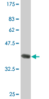 Anti-HAGH antibody (ab55230) at 5 µg/ml + 0.2 µg/lane of partial recombinant HAGH protein with a tagSecondaryGoat anti mouse IgG (H&L)-HRP conjugate at 1/5000 dilution