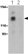 All lanes : Anti-Hamartin antibody (ab25882) at 1 µg/mlLane 1 : EL4 cell lysate with absence of blocking peptideLane 2 : EL4 cell lysate with presence of blocking peptide