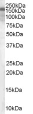Anti-Hamartin antibody (ab48028) at 0.1 µg/ml + 35µg Human brain lysate in RIPA bufferSecondaryanti-goat-HRP at a 1/3000 dilutiondeveloped using the ECL technique