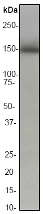 Anti-Hamartin antibody [EP318Y] (ab40872) at 1/20000 dilution + HeLa cell lysate