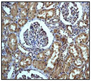 Ab40872 staining human Hamartin in human kidneys by immunohistochemistry using paraffin embedded tissue.Ab40872 staining human Hamartin in human kidneys by immunohistochemistry using paraffin embedded tissue.