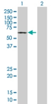 All lanes : Anti-HAPLN1 antibody (ab67767) at 1/500 dilutionLane 1 : HAPLN1 transfected lysateLane 2 : Non transfected lysateLysates/proteins at 25 µg per lane.SecondaryGoat anti-mouse IgG (H&L)-HRP conjugate at 1/2500 dilutionObserved band size : 62 kDa (why is the actual band size different from the predicted?)
