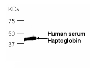 Anti-Haptoglobin antibody (ab75455) at 1/10000 dilution + Human serum at 2 µlSecondaryGoat-anti-IgY/Fc-HRP at 1/10000 dilution