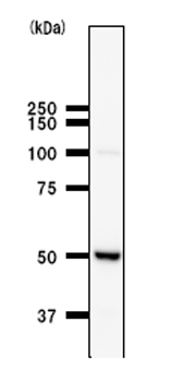 Anti-HARS antibody [HARSA6] (ab50835) at 1/100 dilution + Hela whole cell lysate at 25 µgSecondaryMouse IgG antibody at 1/2500 dilution