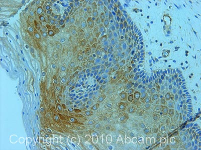 IHC image of ab50835 staining in human cervix formalin fixed paraffin embedded tissue section, performed on a Leica BondTM system using the standard protocol F. The section was pre-treated using heat mediated antigen retrieval with sodium citrate buffer (pH6, epitope retrieval solution 1) for 20 mins. The section was then incubated with ab50835, 1µg/ml, for 15 mins at room temperature and detected using an HRP conjugated compact polymer system. DAB was used as the chromogen. The section was then counterstained with haematoxylin and mounted with DPX.For other IHC staining systems (automated and non-automated) customers should optimize variable parameters such as antigen retrieval conditions, primary antibody concentration and antibody incubation times.