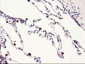 ab123918, at a 1/150 dilution, staining HARS2 in paraffin embedded Human lung tissue by Immunohistochemistry.