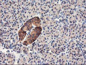 ab123918, at a 1/150 dilution, staining HARS2 in paraffin embedded Human pancreas tissue by Immunohistochemistry.