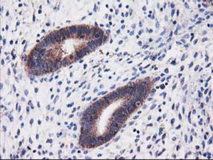 ab123918, at a 1/150 dilution, staining HARS2 in paraffin embedded Human endometrium tissue by Immunohistochemistry.