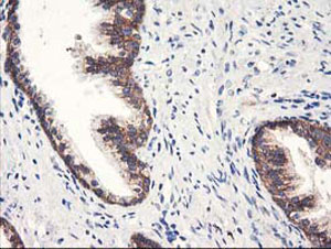 ab123918, at a 1/150 dilution, staining HARS2 in paraffin embedded Human prostate tissue by Immunohistochemistry.