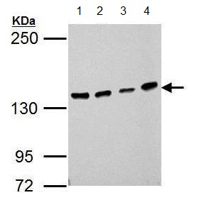 All lanes : Anti-HAUSP / USP7 antibody (ab183659) at 1/1000 dilutionLane 1 : 293T whole cell lysateLane 2 : A431 whole cell lysateLane 3 : HeLa whole cell lysateLane 4 : HepG2 whole cell lysateLysates/proteins at 30 µg per lane.
