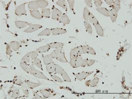 Actin Regulatory Protein CAPG antibody (ab56382) used in immunohistochemistry at 3ug/ml on formalin fixed and paraffin embedded human skeletal muscle.