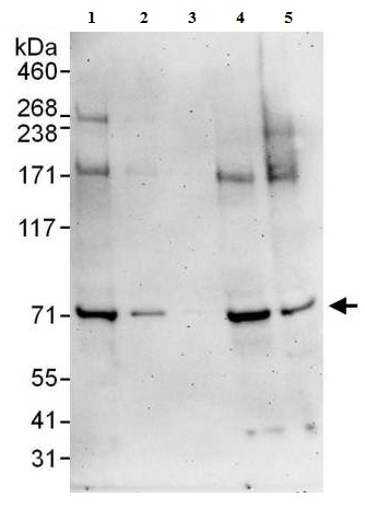 All lanes : Anti-HCE antibody (ab176728) at 0.04 µg/mlLane 1 : HeLa whole cell lysate at 50 µgLane 2 : HeLa whole cell lysate at 15 µgLane 3 : HeLa whole cell lysate at 5 µgLane 4 : 293T whole cell lysate at 50 µgLane 5 : NIH3T3 whole cell lysate at 50 µgdeveloped using the ECL technique