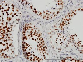 CSTF3 antibody (ab54736) used in immunohistochemistry at 3ug/ml on formalin fixed and paraffin embedded human testis.