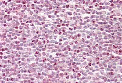 Immunohistochemical analysis of formalin fixed, paraffin embedded Human tonsil tissue labelling HCF-1 / Host Cell Factor C1 with ab139372 at 10 &microg/ml.