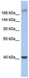 Anti-HCF-1 / Host Cell Factor C1 antibody (ab94631) at 1 µg/ml (in 5% skim milk / PBS buffer) + Human fetal stomach lysate at 10 µgSecondaryHRP conjugated anti-Rabbit IgG at 1/50000 dilution