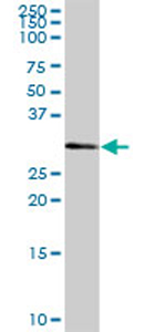 Anti-CSTP1 antibody (ab69427) at 1/500 dilution + human liver tissue lysate at 25 µgSecondaryGoat Anti-Mouse IgG (H&L)-HRP Conjugate at 1/2500 dilution