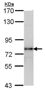 Anti-hCG receptor antibody (ab96603) at 1/1000 dilution + H1299 whole cell lysate at 30 µg
