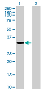 All lanes : Anti-CSTP1 antibody (ab69427) at 1/500 dilutionLane 1 : CSTP1 transfected 293T cell lysateLane 2 : Non-transfected 293T cell lysateLysates/proteins at 25 µg per lane.SecondaryGoat Anti-Mouse IgG (H&L)-HRP Conjugate at 1/2500 dilution