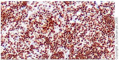 The image shows staining of human tonsil tissue using ab19845. Staining was nuclear and was equally successful using Tris EDTA pH9 or Citrate pH6 for antigen retrieval. Staining was prevalent in almost all cellular compartments of the tonsil.