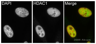 ab19845 at a 1/3000 dilution staining asynchronous HeLa cells by ICC/IF. The cells were paraformaldehyde fixed and immunofluorescently labelled with ab19845 for 30 minutes at room temperature. Bound antibody was detected using a Cy3 conjugated goat anti-rabbit antibody. Nuclei were visuallised using DAPI staining. The antibody was found to be highly enriched in the nucleus. This image is courtesy of an Abreview submitted by Kirk McManus.See Abreview