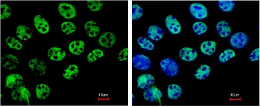 Immunofluorescence analysis of paraformaldehyde fixed A431 cells, labelling HDAC1 with ab137652 at 1/200 dilution (left), costained with a DNA probe (right).